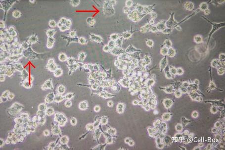 细胞空泡—一种细胞病变现象及其影响 - 知乎
