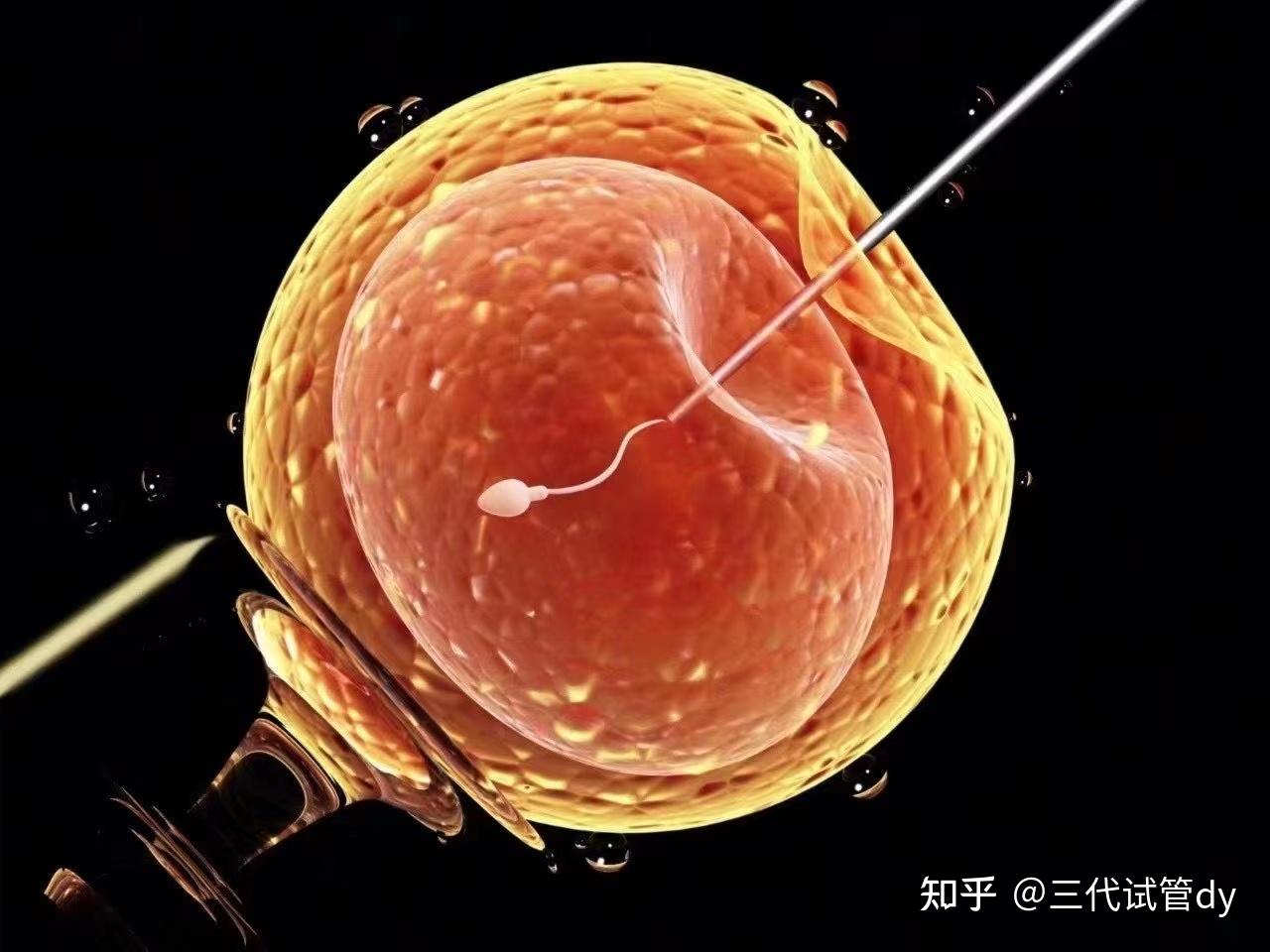 怎样才能让试管婴儿移植成功率高"转灾为福"-第1张图片-凯飞博客