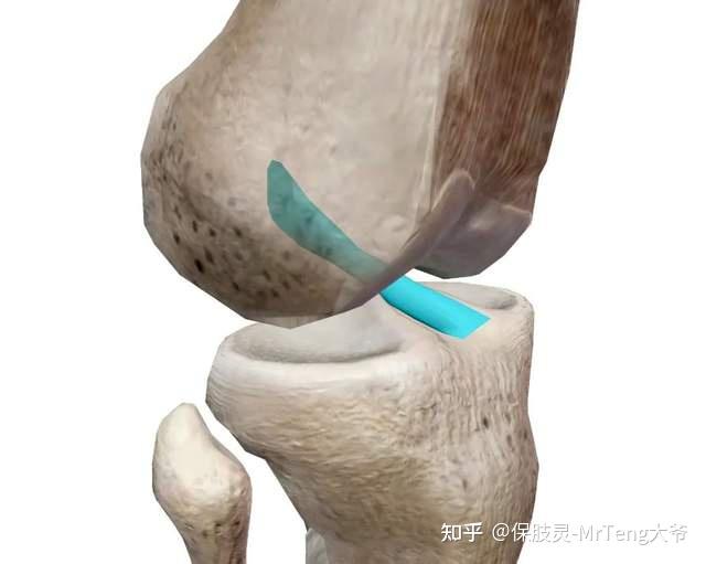 打篮球前十字交叉韧带断裂,到底该如何康复? - 知乎