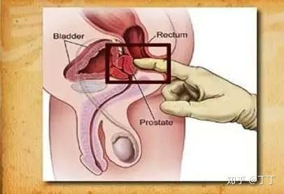 让你 干性高潮 的前列腺按摩 到底如何操作 知乎