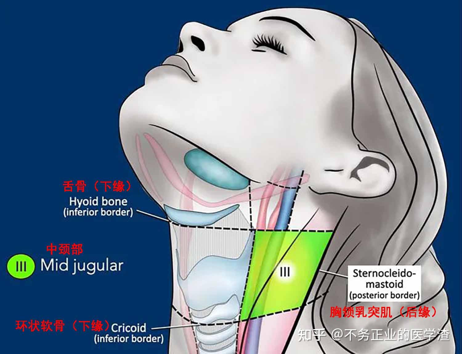 2013颈部淋巴结分区