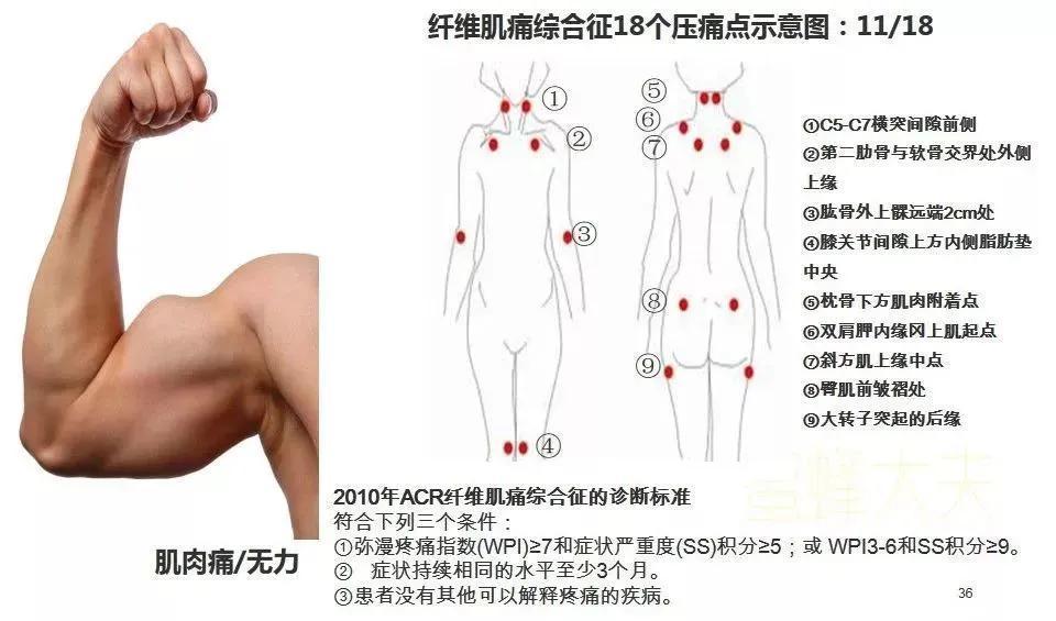 大圆肌激痛点图片