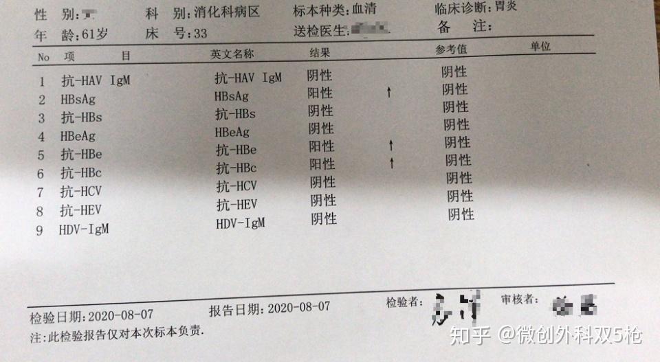 肝癌的原因有很多,例如乙肝,丙肝,还有酒精肝,药物引起的肝硬化等