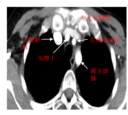 影像学——循环系统 - 知乎
