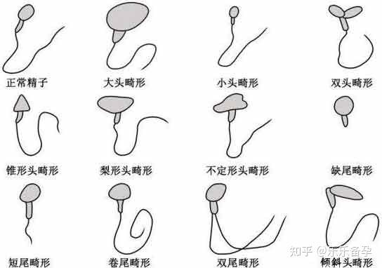 精子的数量和活性可以决定卵子的受精.