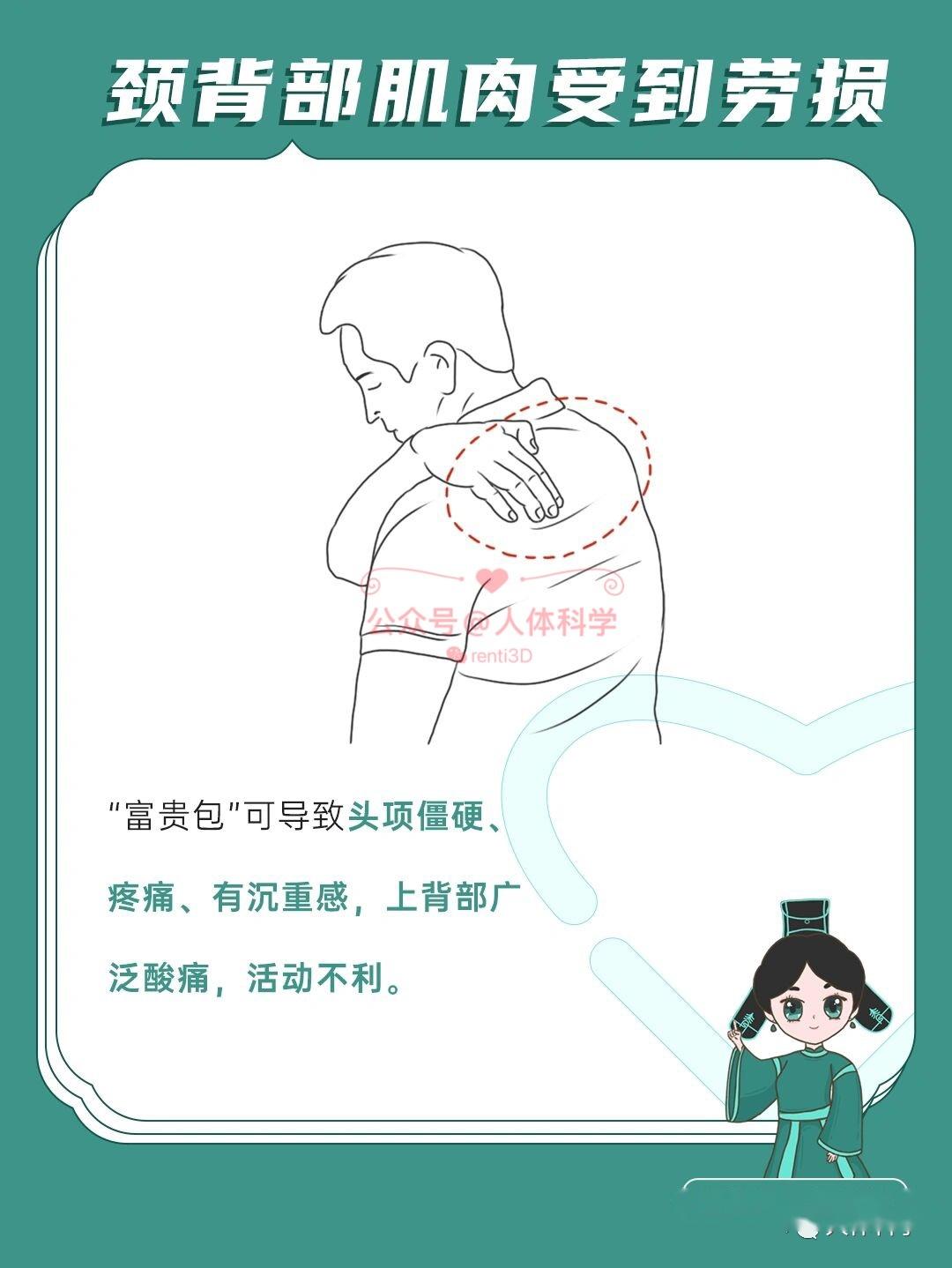 14什么是富贵包14"富贵包"指的是在后背上部颈