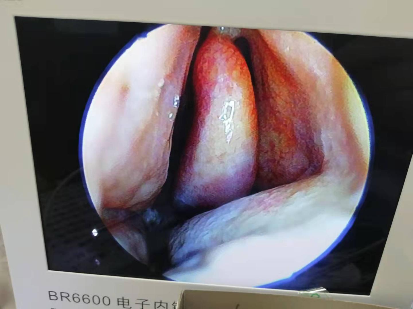 鼻子干燥怎么办最快方法 v2-6acf0d57ea6a1c360222961eb5d4a6d7_1440w.jpg?source=172ae18b