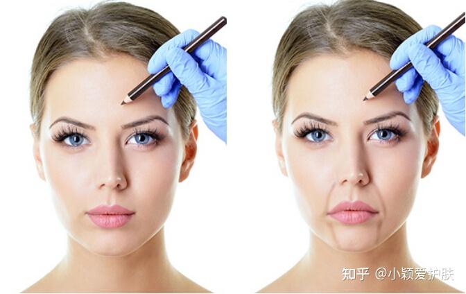 护肤篇——你的法令纹需要拯救了,减龄5岁不是梦 - 知乎