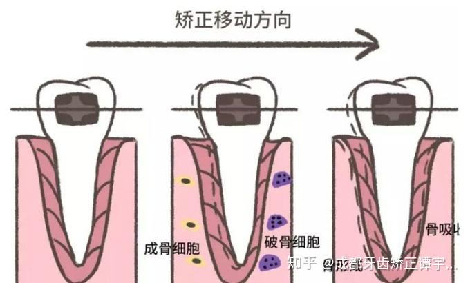 面部生长发育的潜力,以确保牙齿移动及牙槽骨改建的效率达到最佳状态