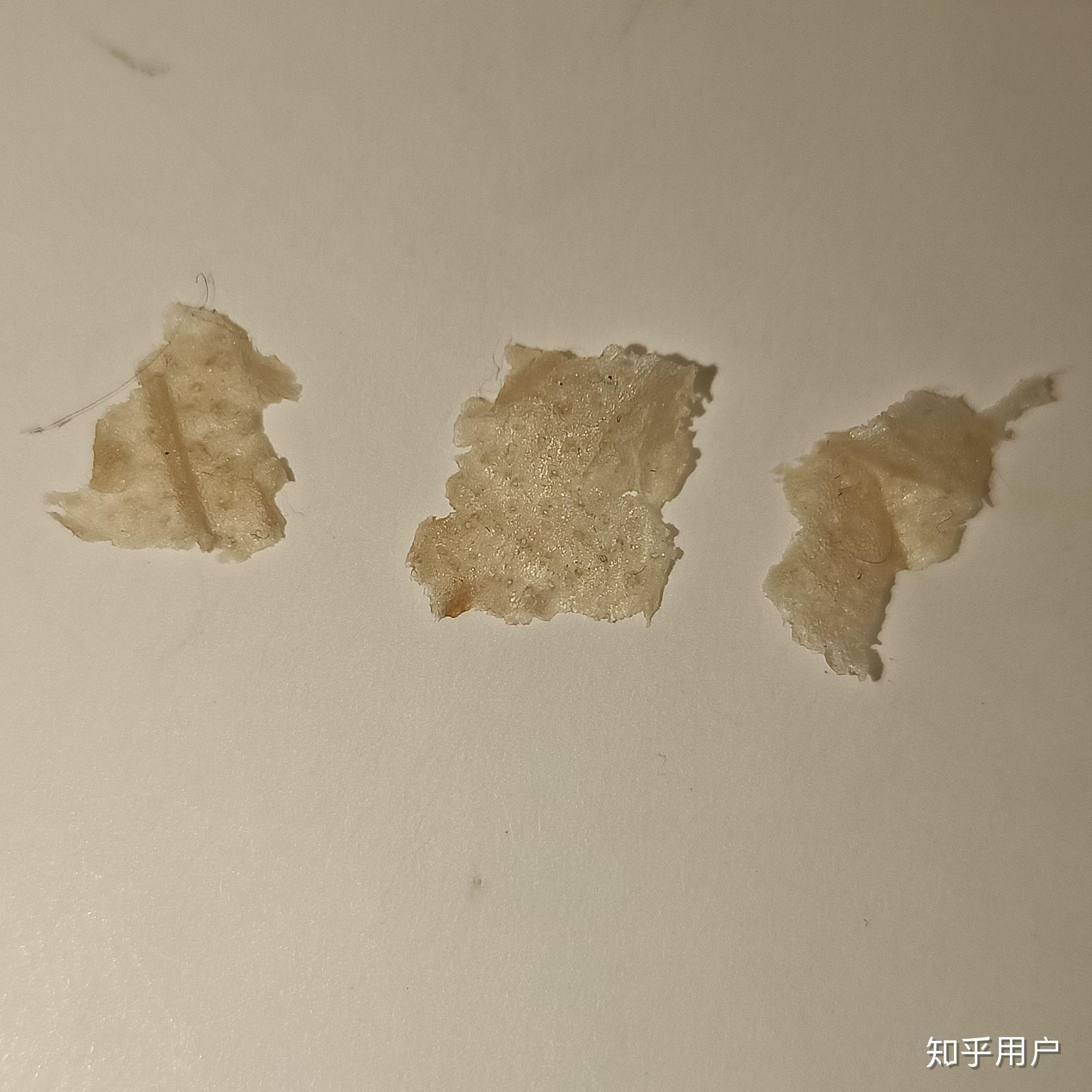 為什麼摳下來大塊的頭皮屑會有瞬間的快感