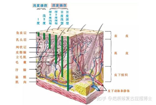 小儿烧伤严重程度划分和成人不同,分类如下