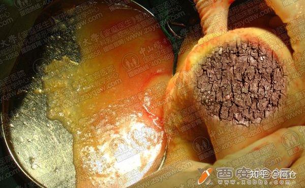 怎么知道哪些整形医院是三甲医院?