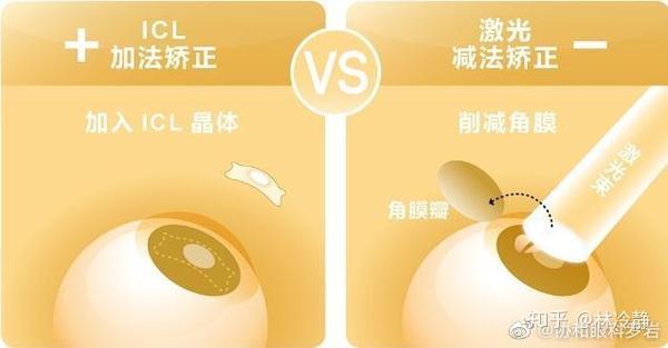 高度近视北京协和医院icl晶体植入手术过程全纪录 知乎