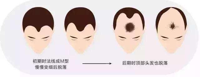 什么是aga Aga是如何运作的 知乎 什么是aga Aga是如何运作的 知乎