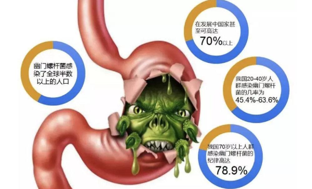 幽门螺杆菌是怎样危害人体健康的?又该如何科学预防? - 知乎