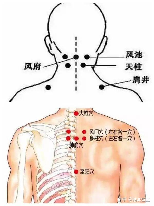 操作結束,他明顯覺得背僵,後腦勺脹痛的情況,有不同程度的減輕.