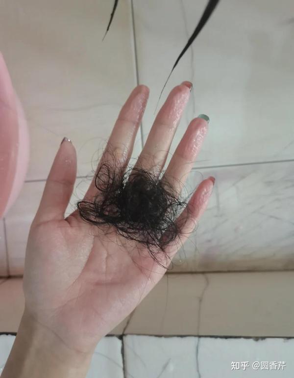 女生,脱发严重,一掉一大把,怎么办?