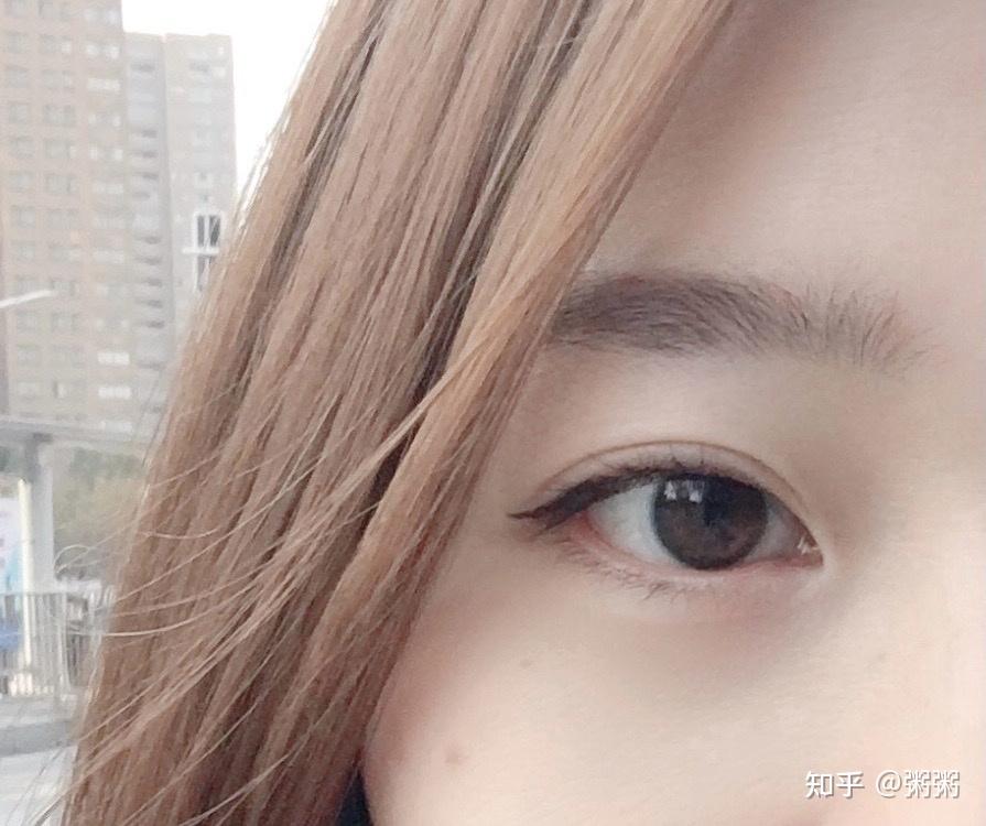 郑州双眼皮自然款四个月分享