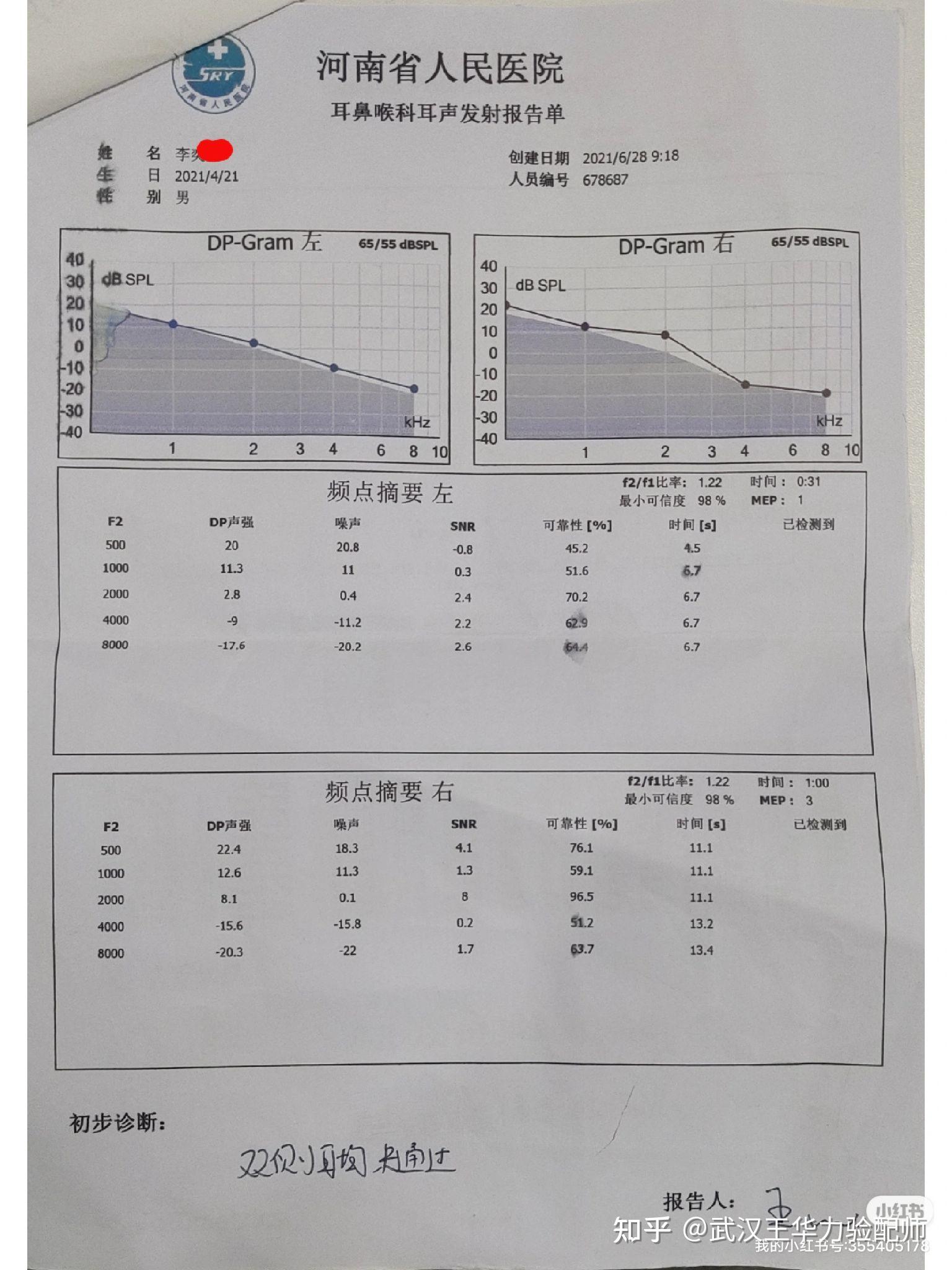 年2岁,出生时听力筛查未通过,2个月龄时在河南省人民医院复查电子耳镜