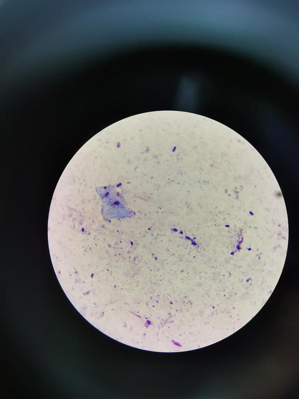 一些严重的耳道感染会导致耳道上皮破损,这时候做的显微镜镜检还能