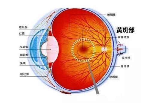 哪些是常见导致眼底病变的原因 知乎