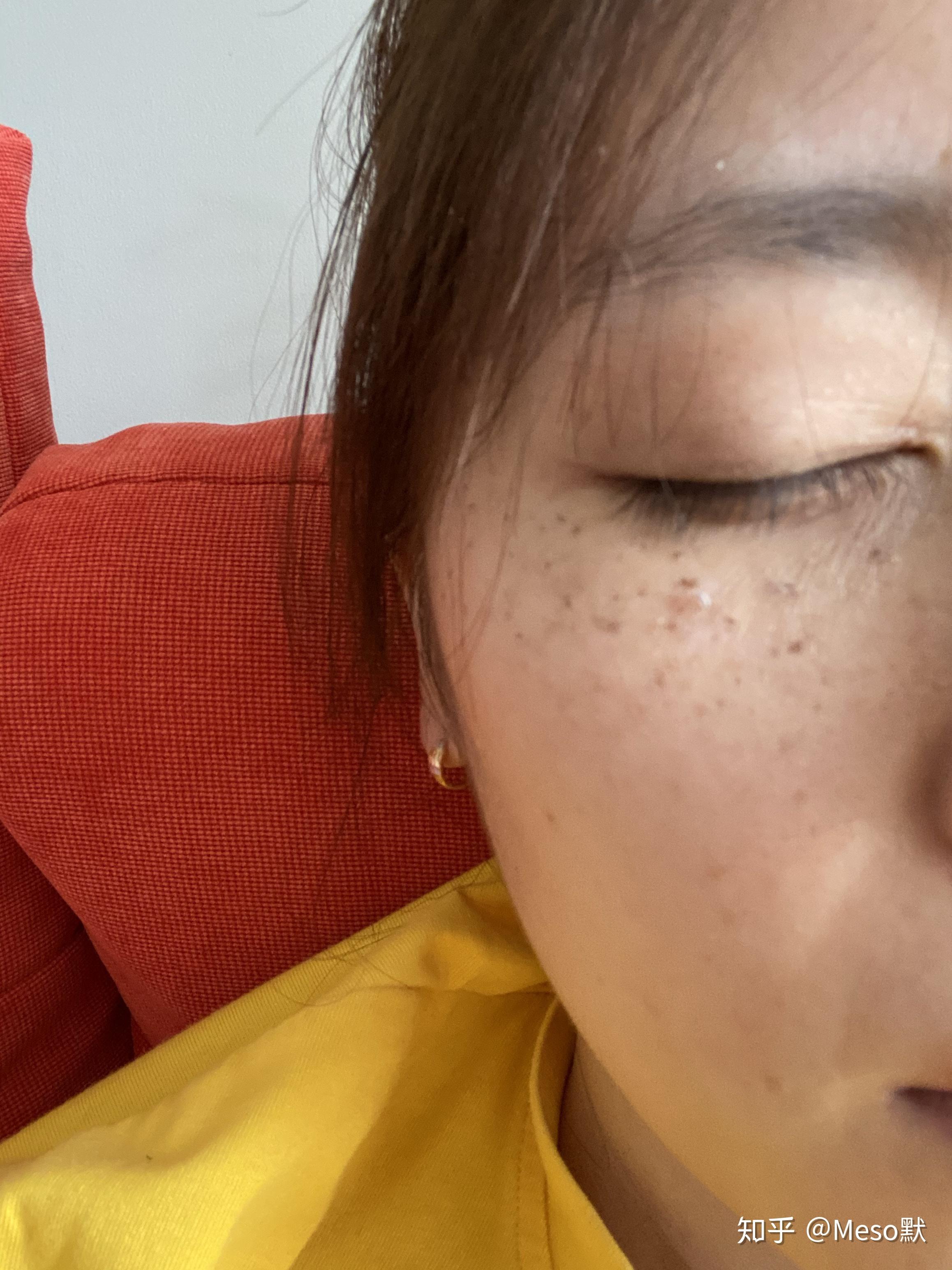 八大处整型医院全天票贩子号贩子-八大处整形医院特需专家挂号费是多少 