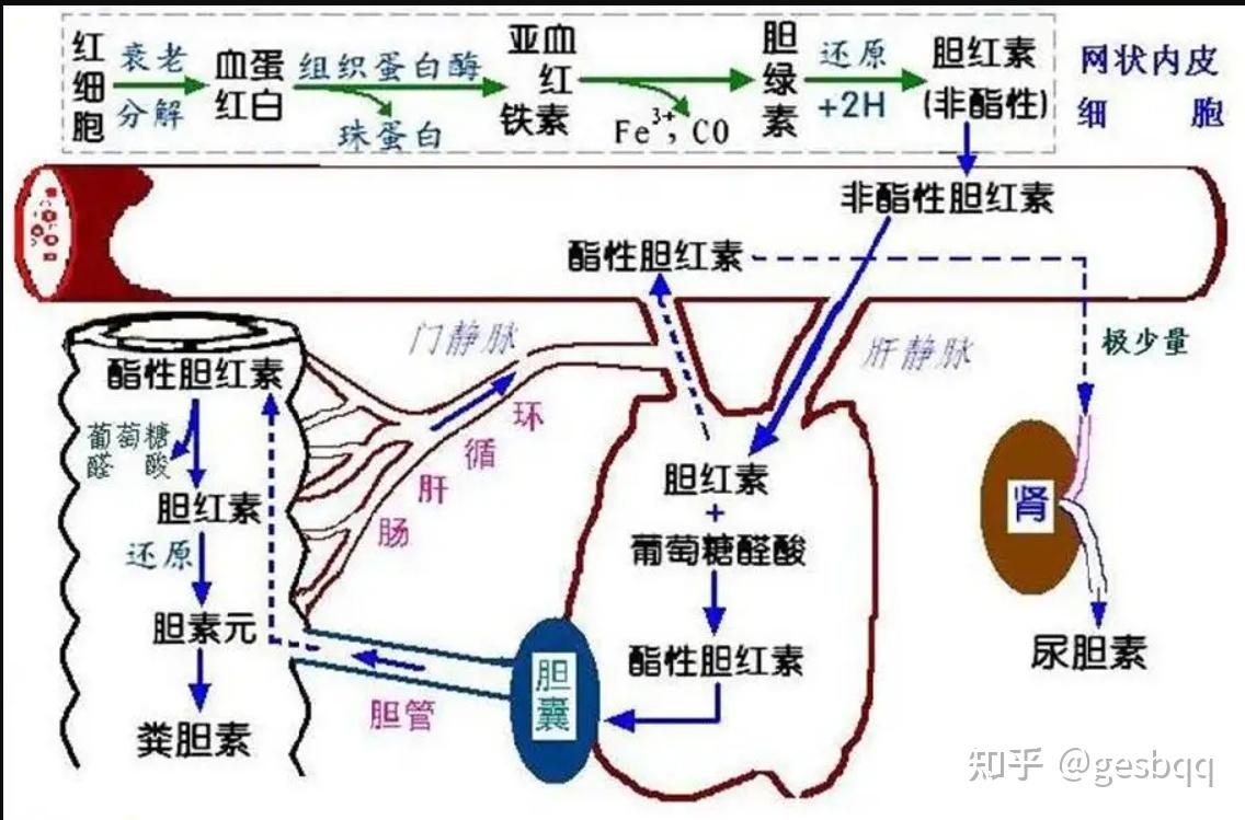 胆红素正常代谢示意图图片