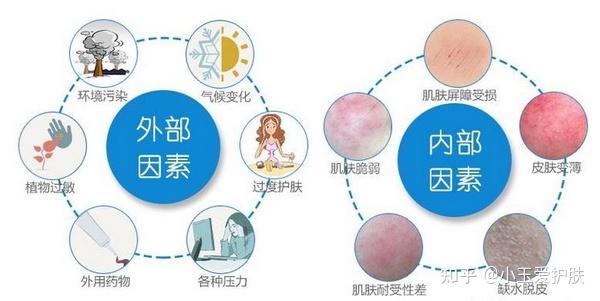 别敏感过敏傻傻分不清楚了