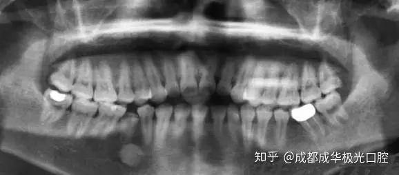 v2-6ccf0b0f11ab34774ae54ca92107444e_r.jpg