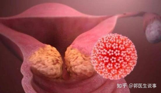 菜花是什么病图片