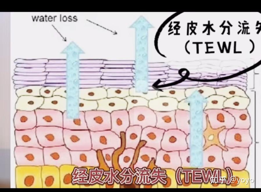 这个时候我们要做的就是减少经皮水分流失(tewl),也就是保护我们皮肤