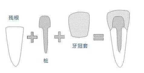门牙缺了一小块怎么办 - 知乎