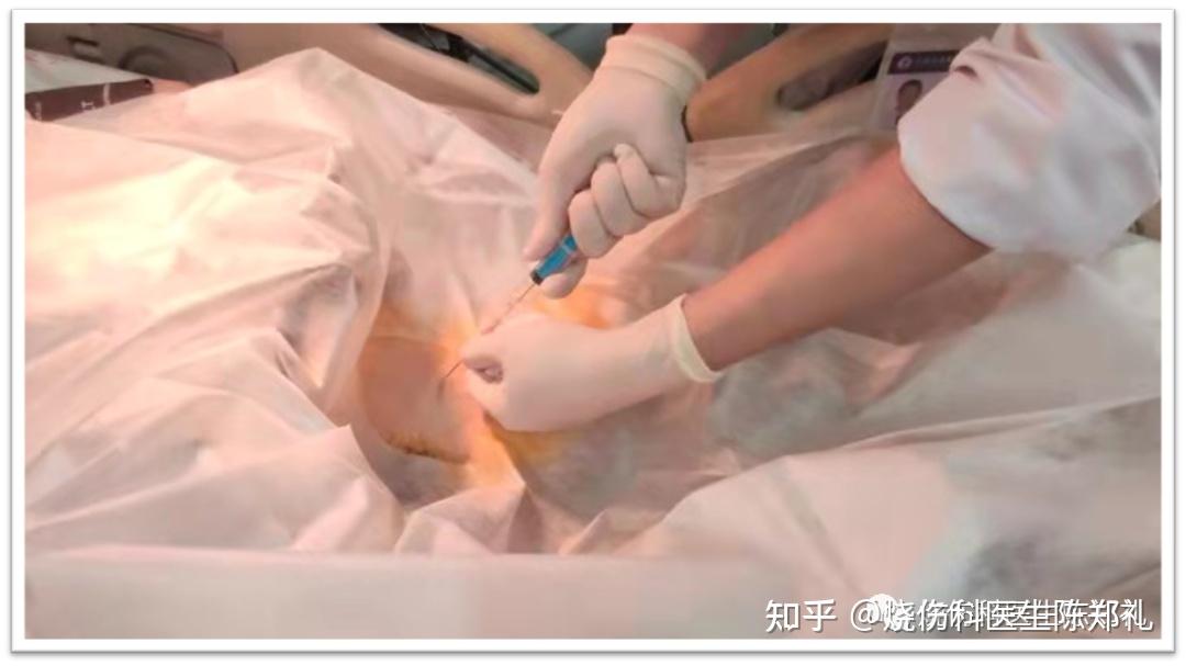 医生如何做科普六完结篇