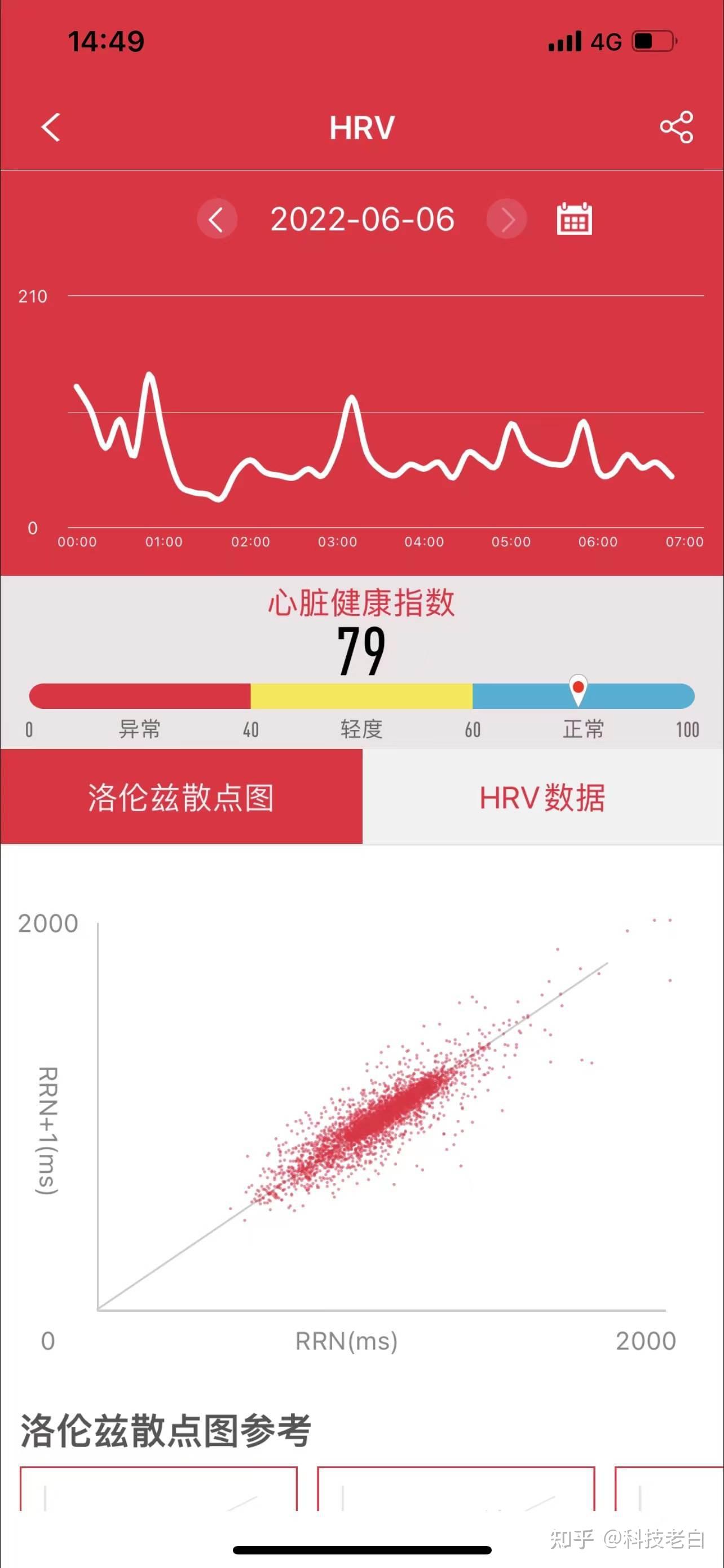 实时监测hrv(心率变异性) 32种常规疾病心电图筛查 洛伦兹散点报告,三