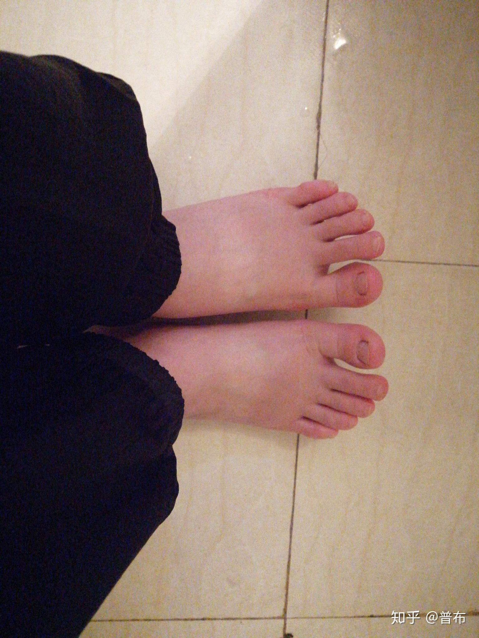 女生脚丑是种什么样的体验?