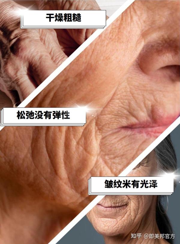 人体衰老的过程就是胶原蛋白流失的过程 - 知乎