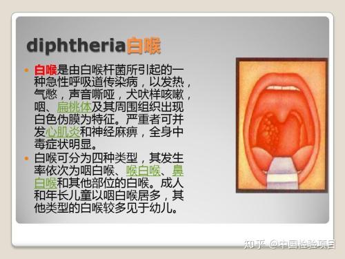 白喉杆菌抗体检测试剂说明书