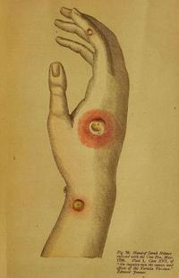 怎么才能当上中医 v2-6df5cf7220794427cda8e5311d66edce_120x160.jpg