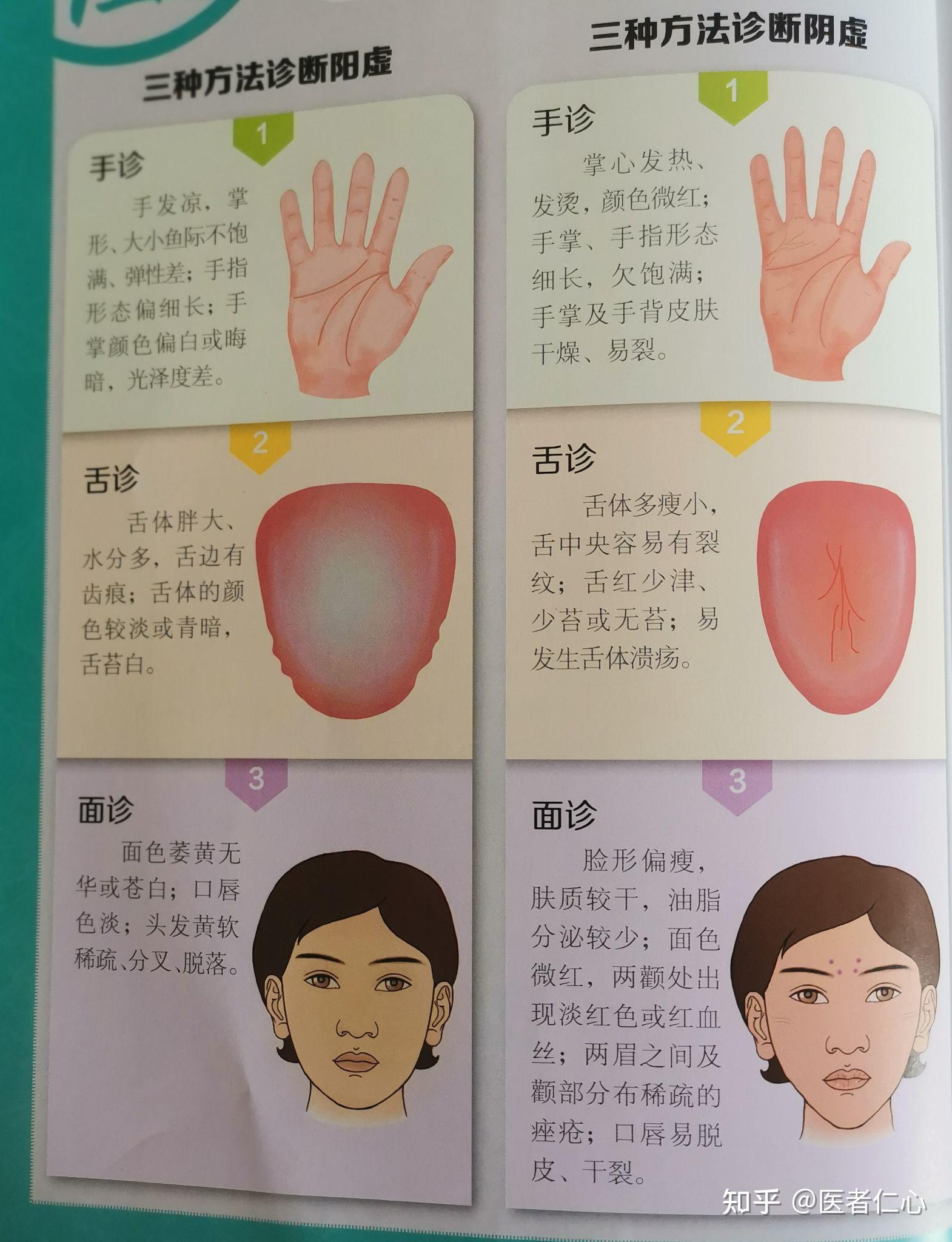 阴虚、阳虚分不清?一图教你如何区分 - 知乎