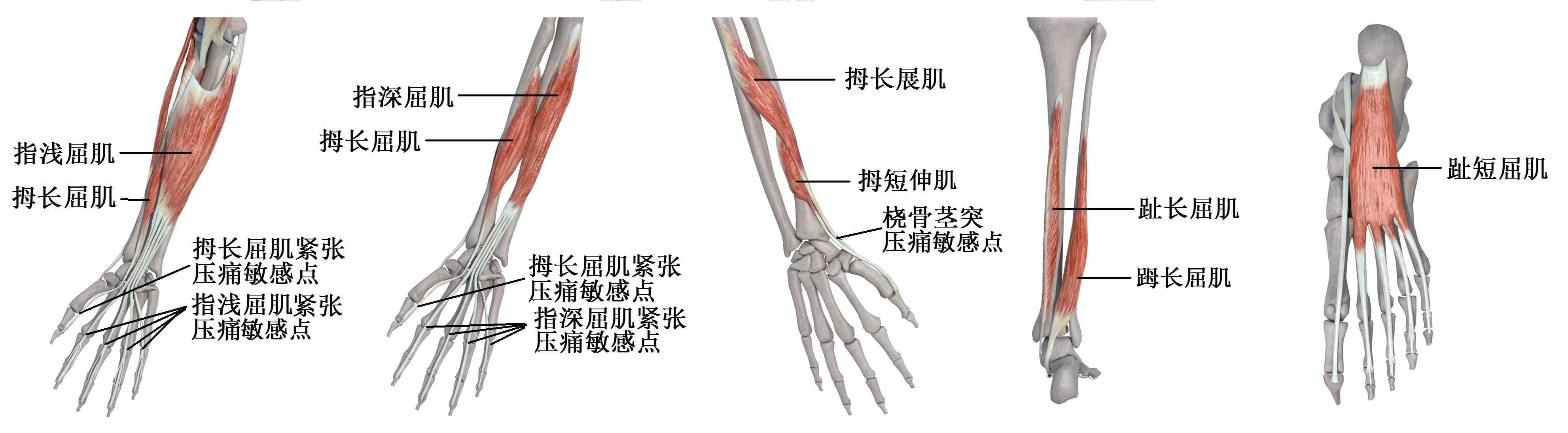 引发腱鞘炎(腱鞘痛,肌腱痛)最常见的肌肉有拇长屈肌,指深(浅)屈肌,拇