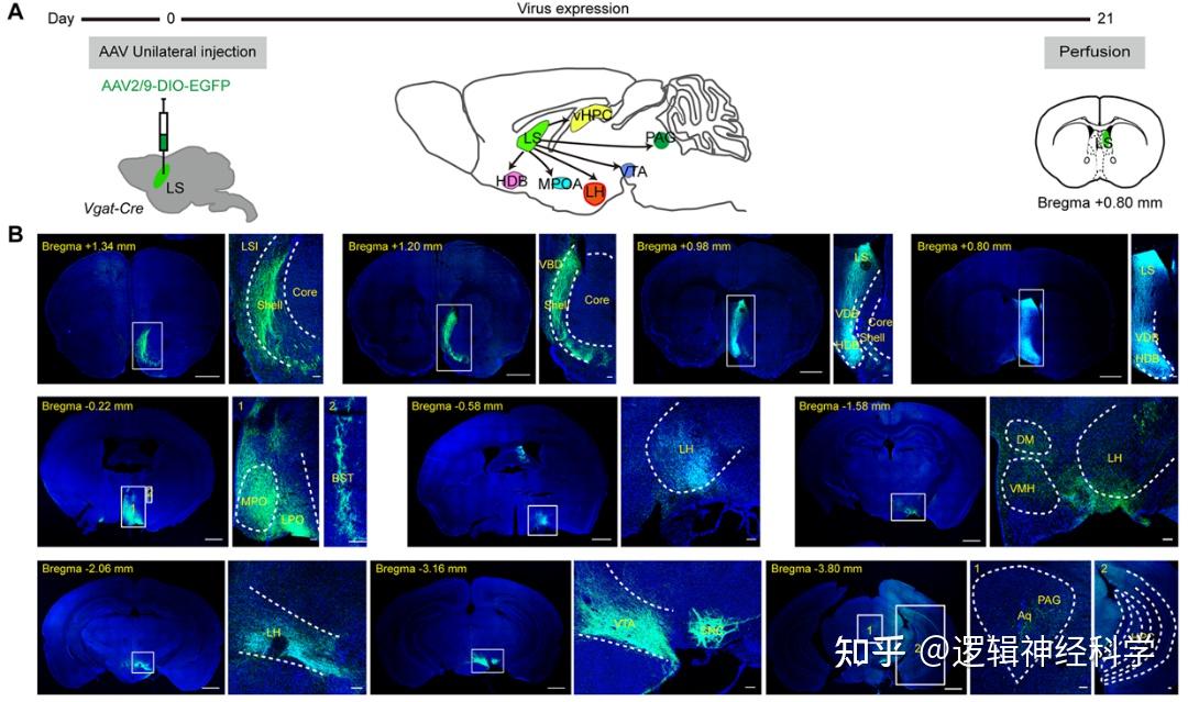 Mol Psychiatry︱杨春/曹君利/刘存明团队揭示外侧隔核向下丘脑外侧区GABA能神经元投射在疼痛和焦虑共病调控中的作用 - 知乎