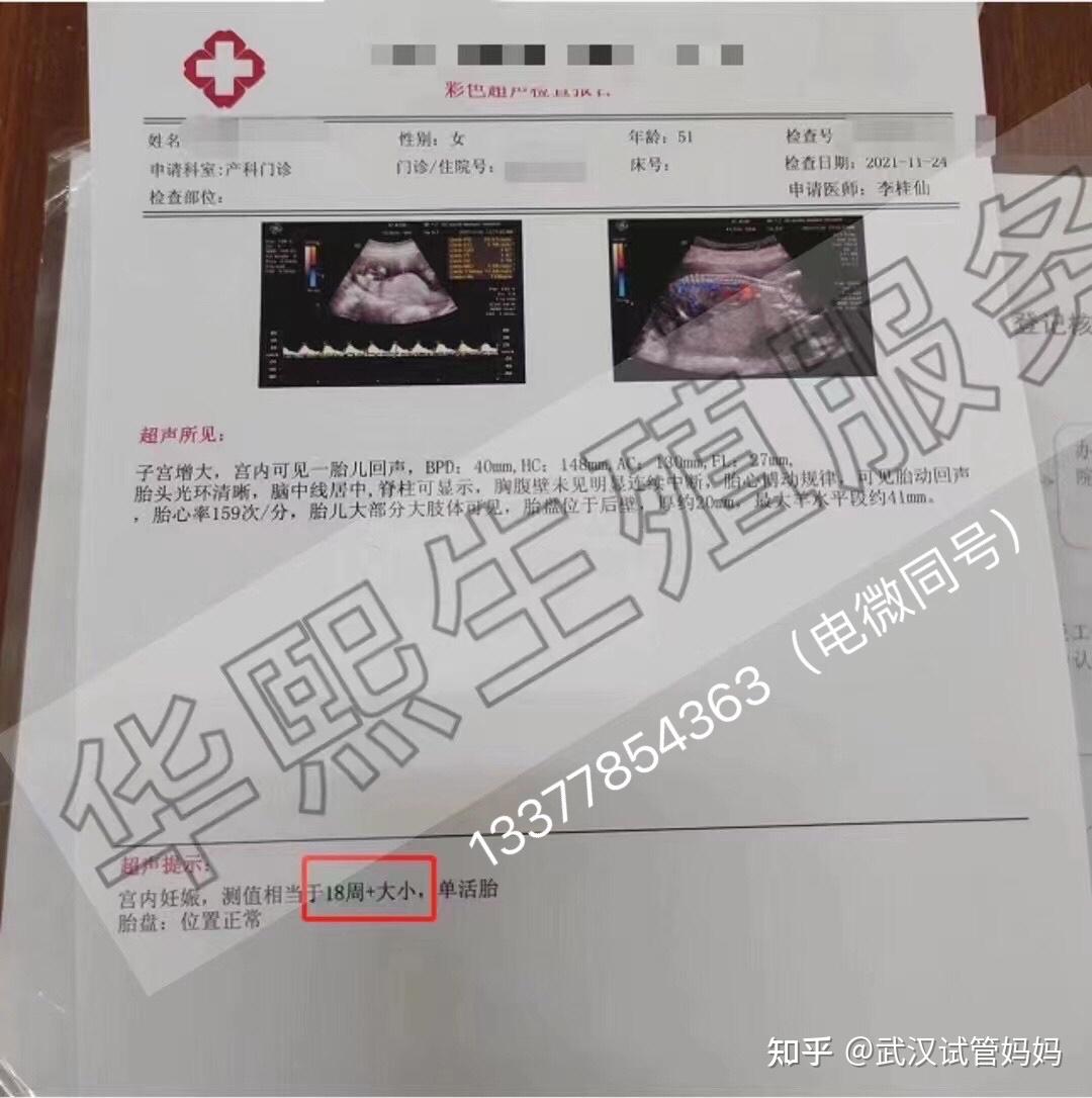 高龄试筦dna顺利通过了哦 知乎