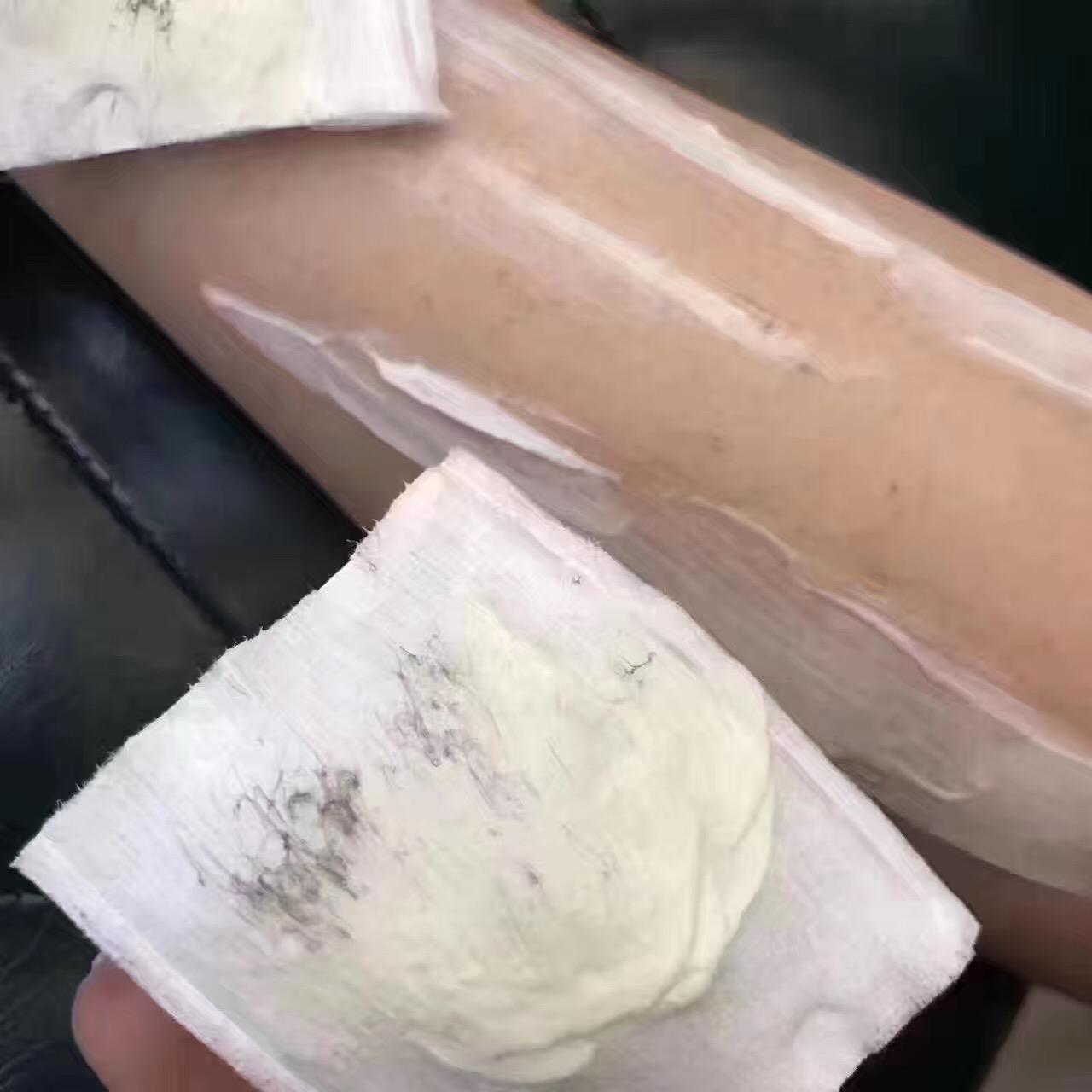 脱毛之后擦身体乳疼怎么办(脱毛之后擦身体乳疼怎么办呢)