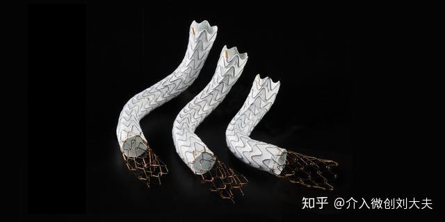 最常见的原因为分流道支架失功能(支架狭窄或闭塞),导致门静脉高压