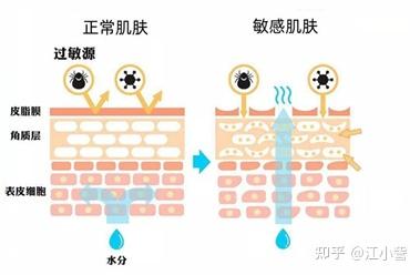 敏感皮肤用什么护肤品 这款小众平价好物值得一试 知乎