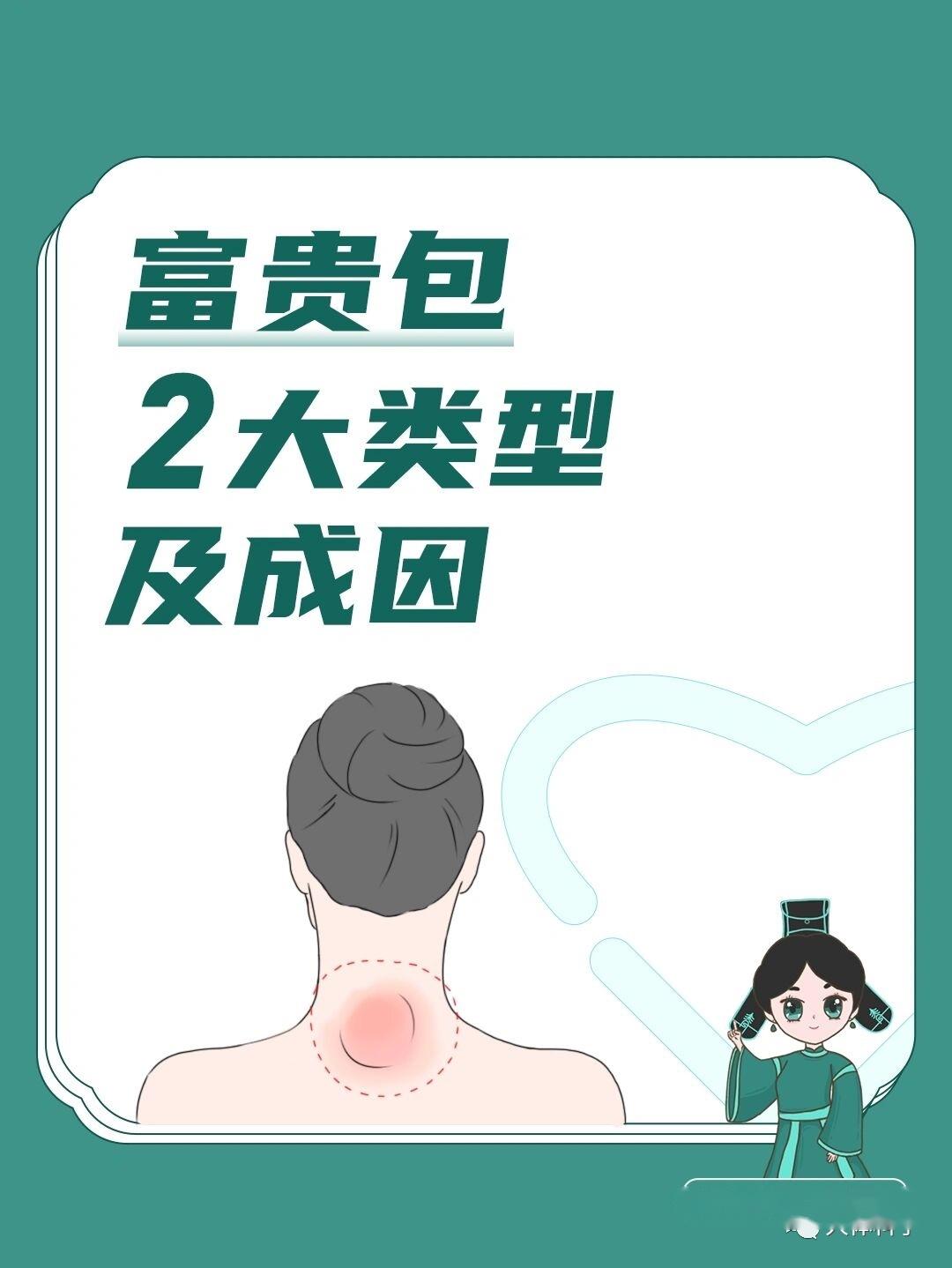 14什么是富贵包14"富贵包"指的是在后背上部颈