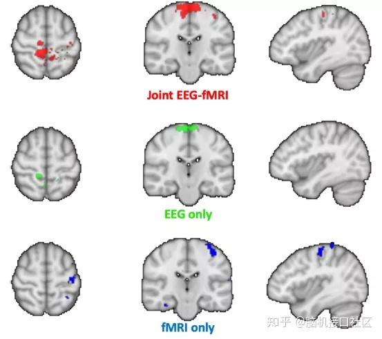 在神经反馈任务中同时进行EEG-fMRI，多模态数据集成的大脑成像数据集 - 知乎