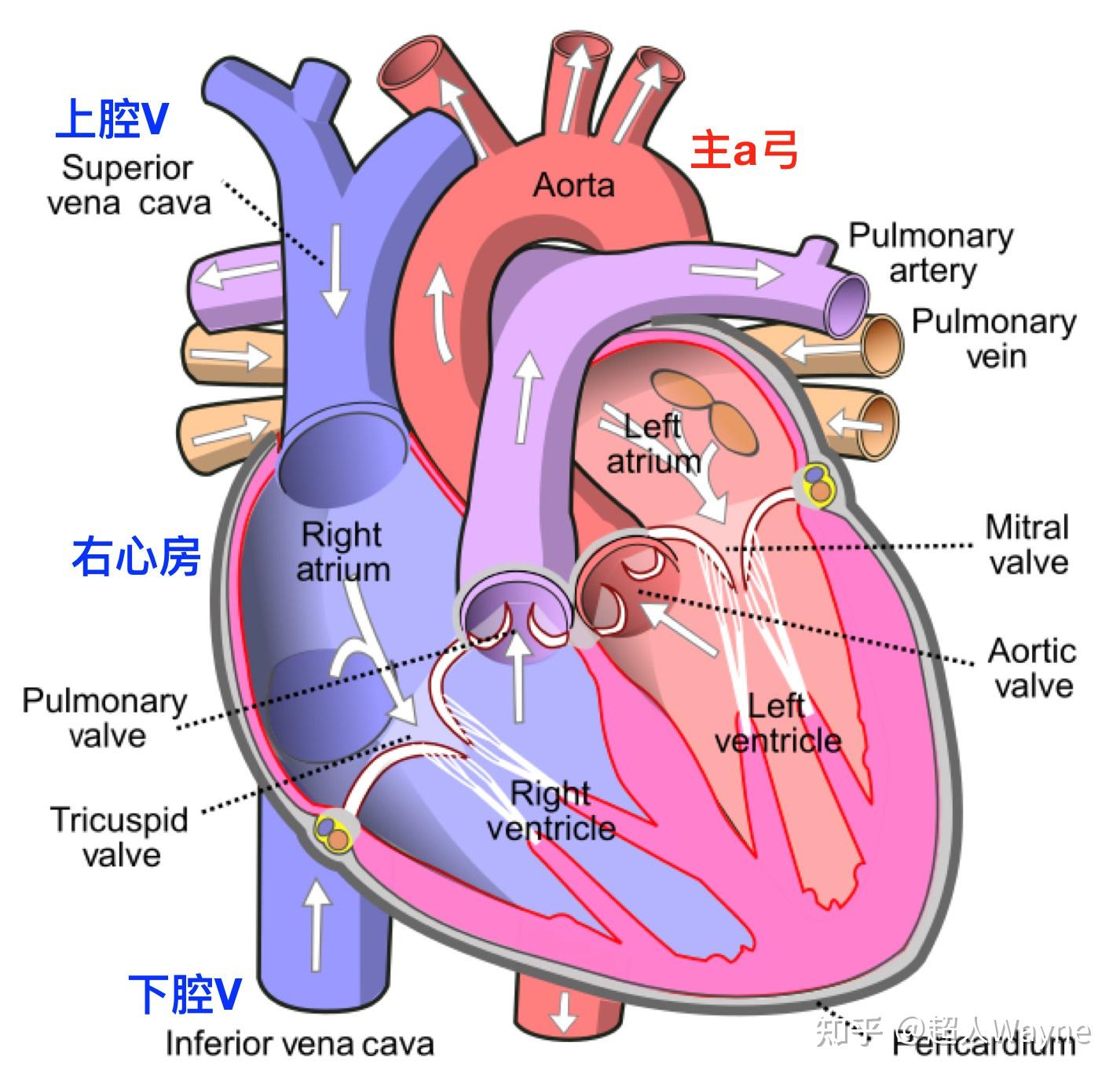 ivc