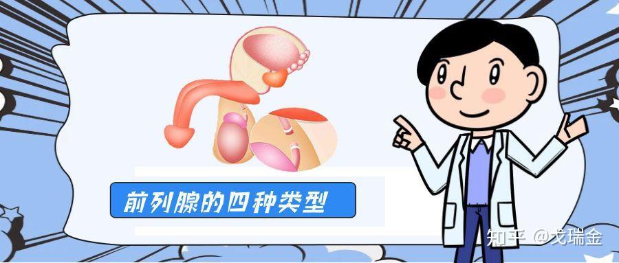 慢性前列腺炎什么症状表现? - 知乎