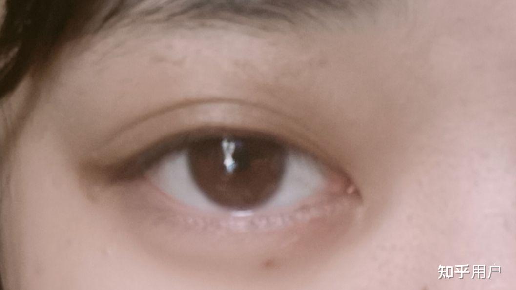 抑郁的人眼神都很空洞吗